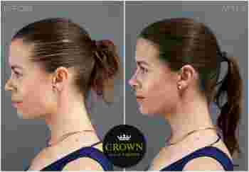 CROWN5
